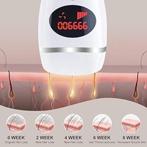 Épilation permanente à laser|Système d’épilation|IPL|AMINZER - Image 6