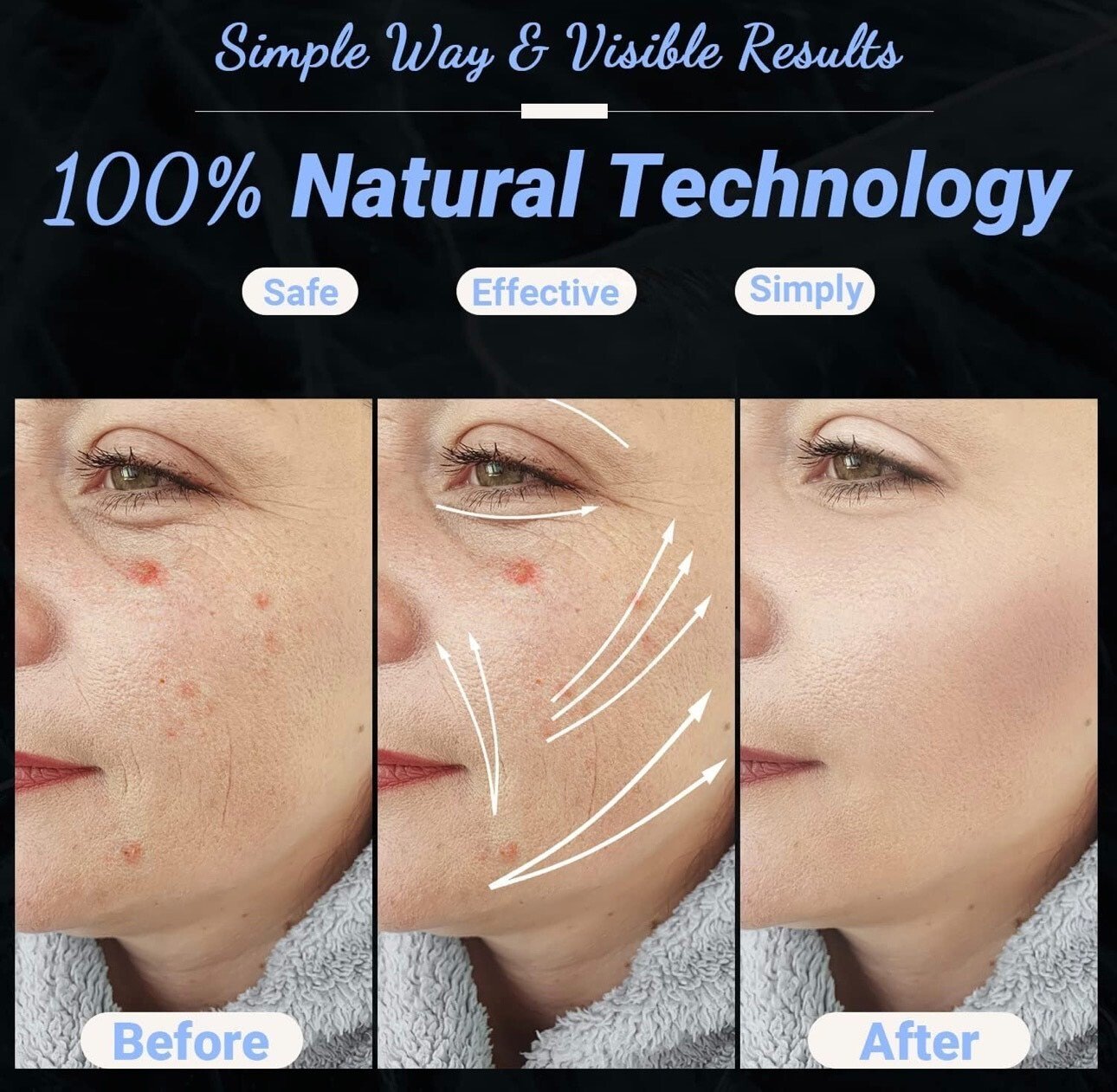 Appareil à haute fréquence|Machine faciale|Stimulation des racines|Santé|UUPAS - Image 5