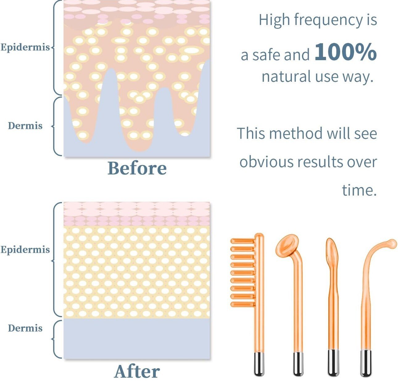Appareil à haute fréquence|Machine faciale|Stimulation des racines|Santé|TUMAKOU - Image 5